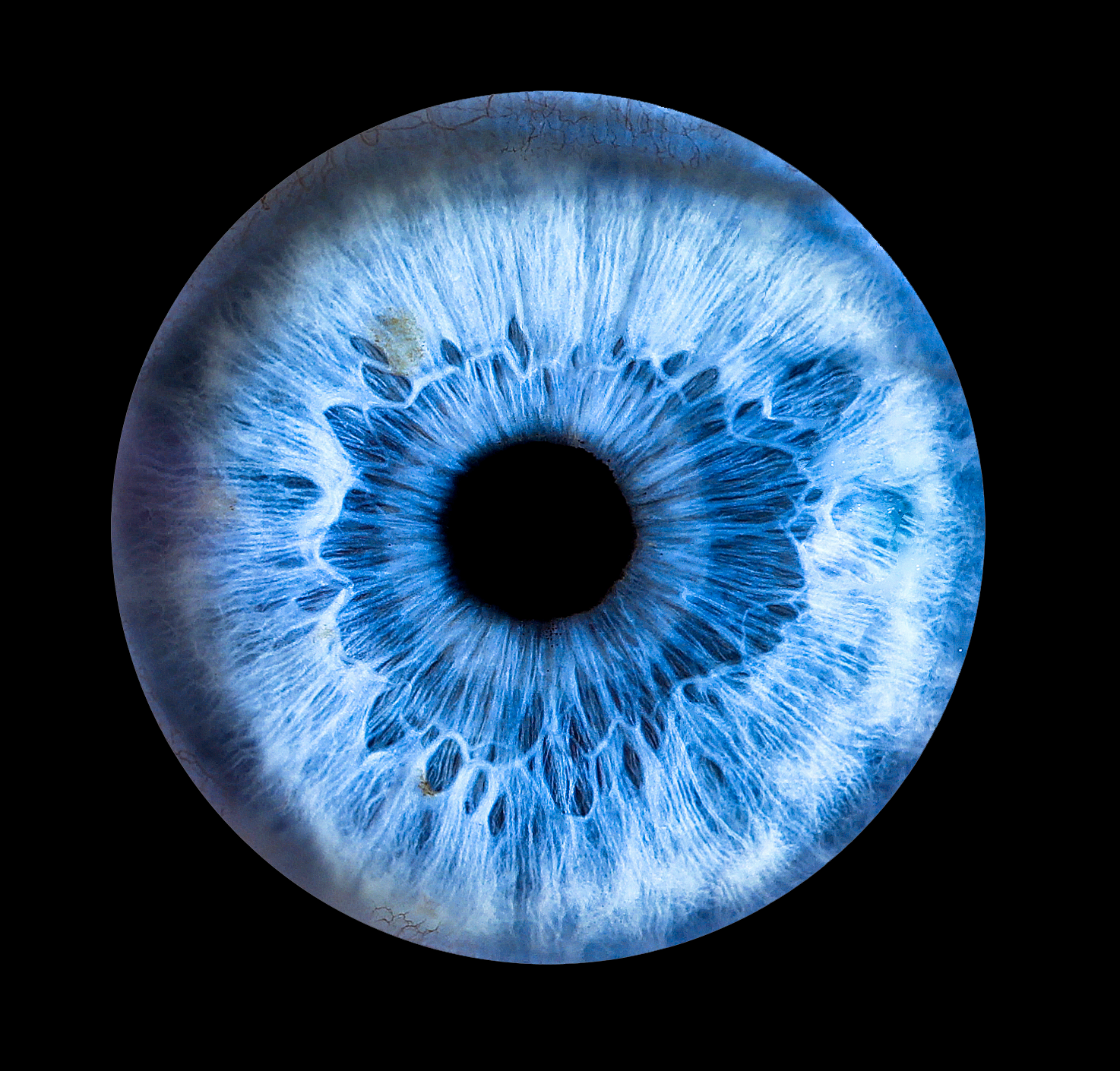 Iris bleu,  iridologie