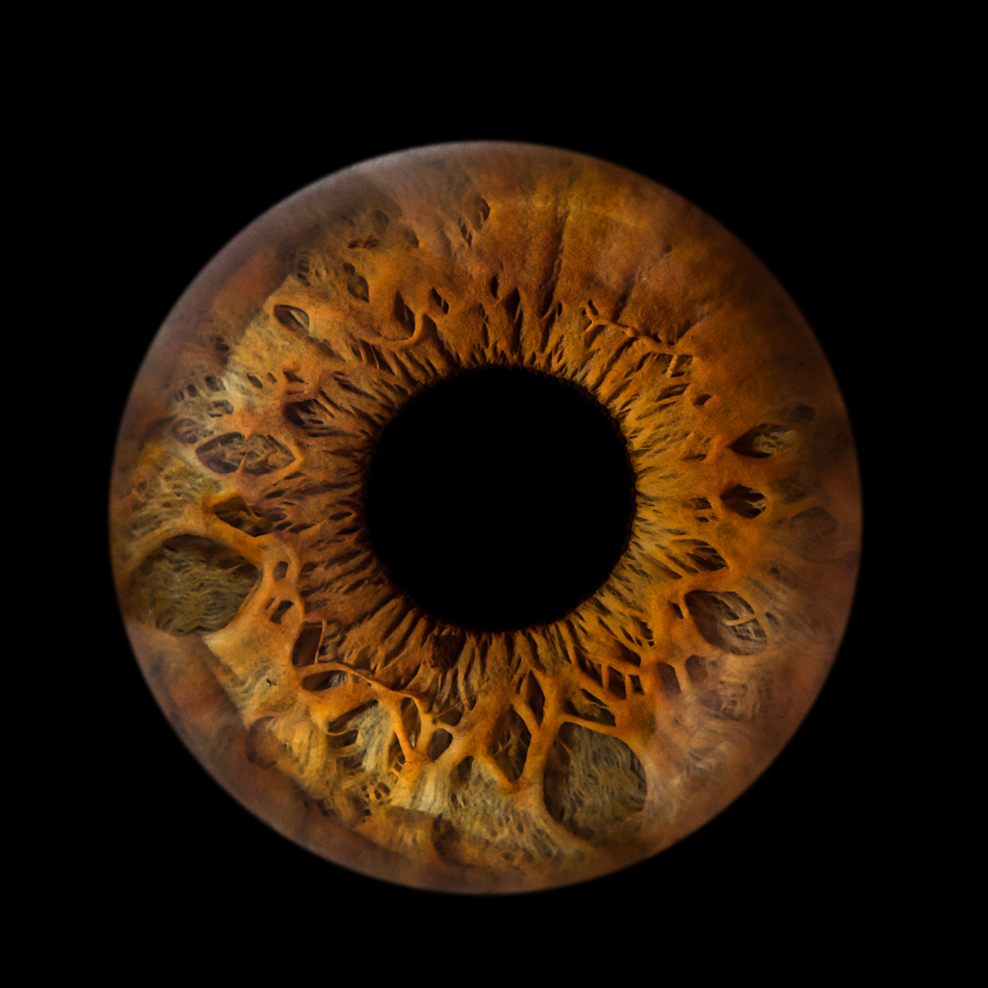 Iris maron, forte lacune iridologie