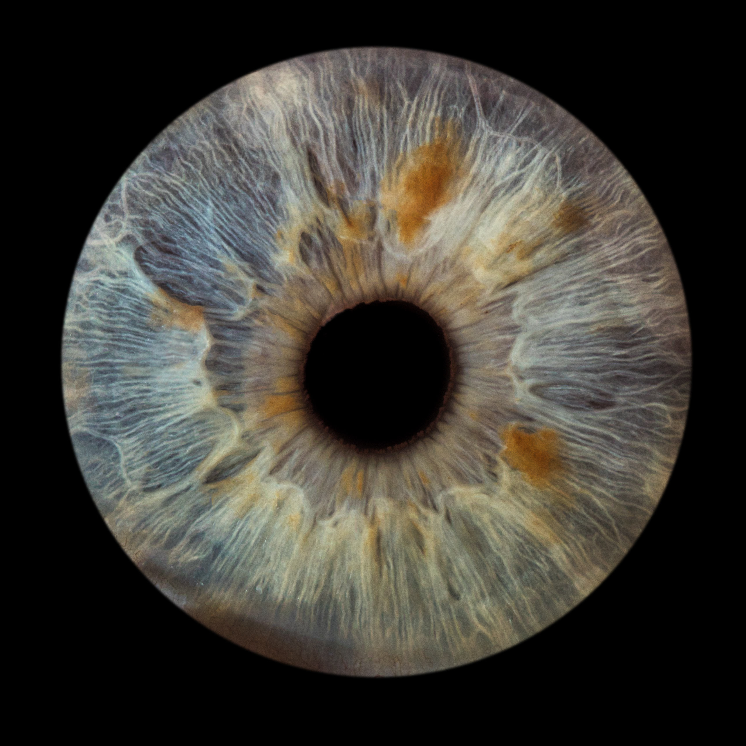 Photo iris, yeux bleu. Iridologie